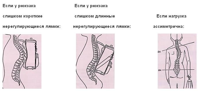 Как влияет вес рюкзака на осанку проект 4 класс