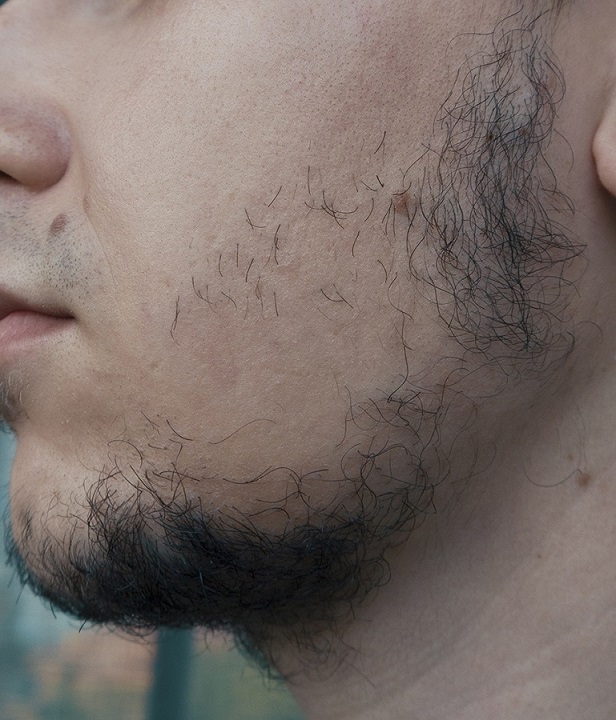 Как у трансов растет борода